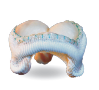 VÁLVULA CARDÍACA  BIOLÓGICA HFS CON STENT  ALTAMENTE FLEXIBLE